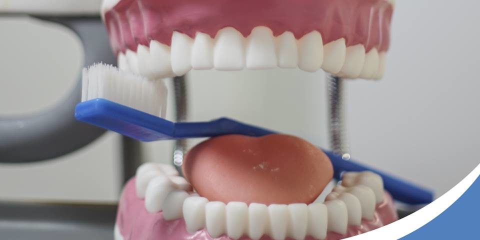 Preguntas frecuentes sobre fundas dentales