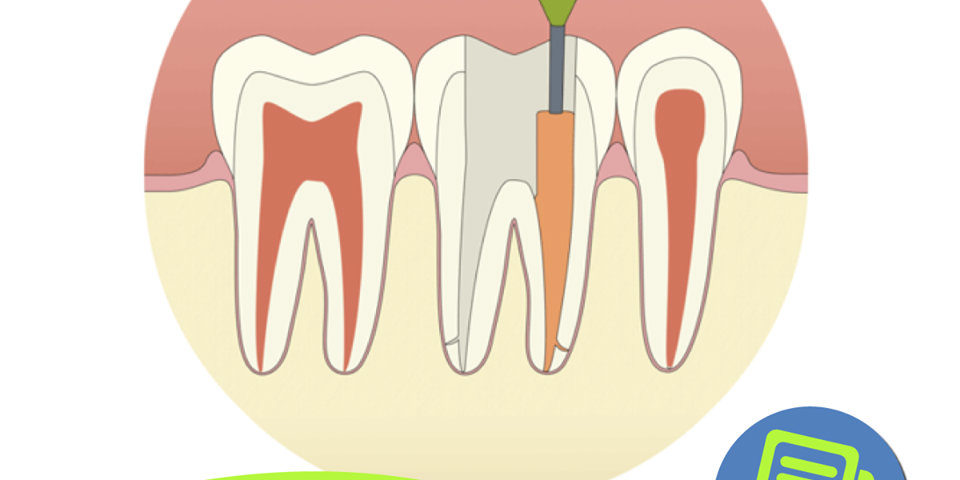 Efectos de la menopausia en la salud dental